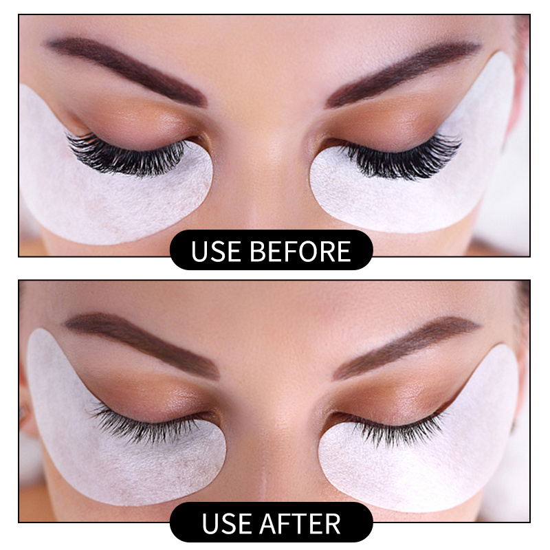 20g Estensione Delle Ciglia Co - Eyelash Extension Eye Irritation recensione e prezzo